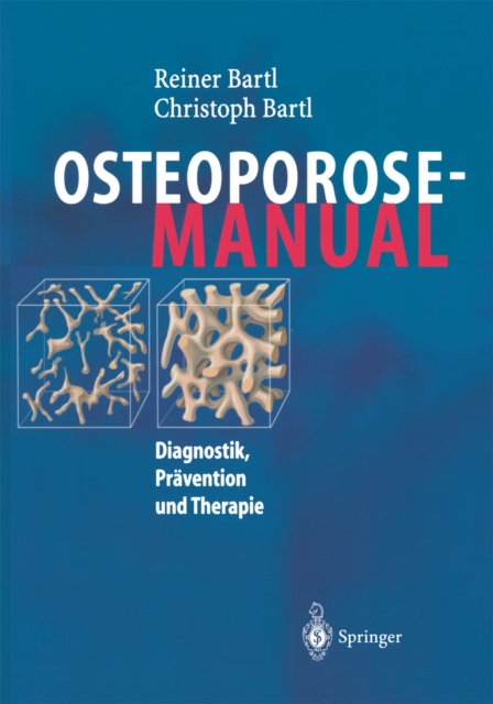 Osteoporose-Manual : Diagnostik, Pravention und Therapie, PDF eBook