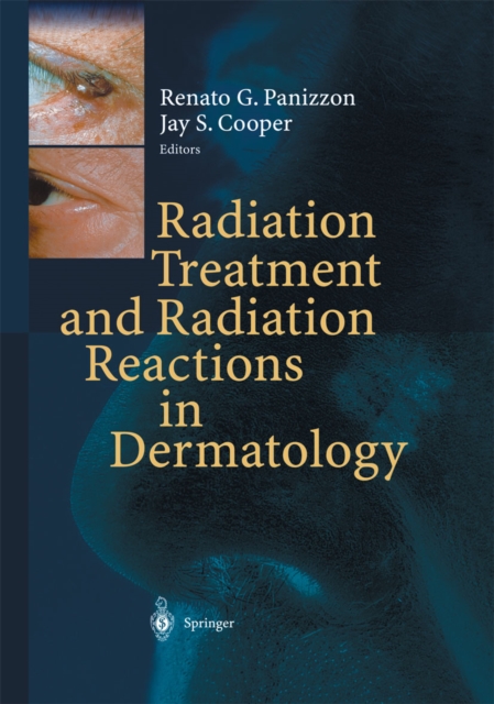 Radiation Treatment and Radiation Reactions in Dermatology, PDF eBook