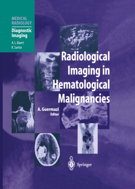 Radiological Imaging in Hematological Malignancies, PDF eBook