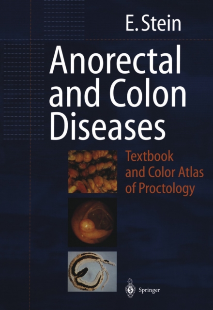 Anorectal and Colon Diseases : Textbook and Color Atlas of Proctology, PDF eBook