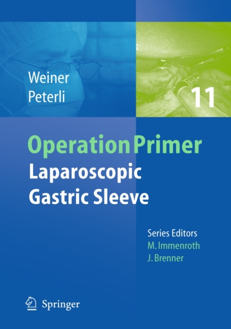Laparoscopic Gastric Sleeve, Paperback Book
