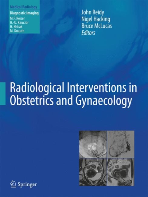 Radiological Interventions in Obstetrics and Gynaecology, EPUB eBook