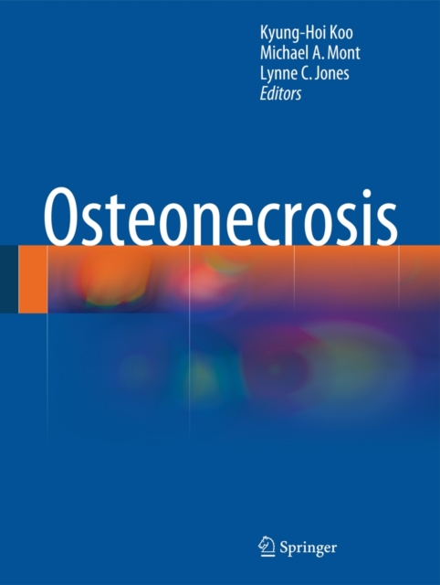Osteonecrosis, Hardback Book