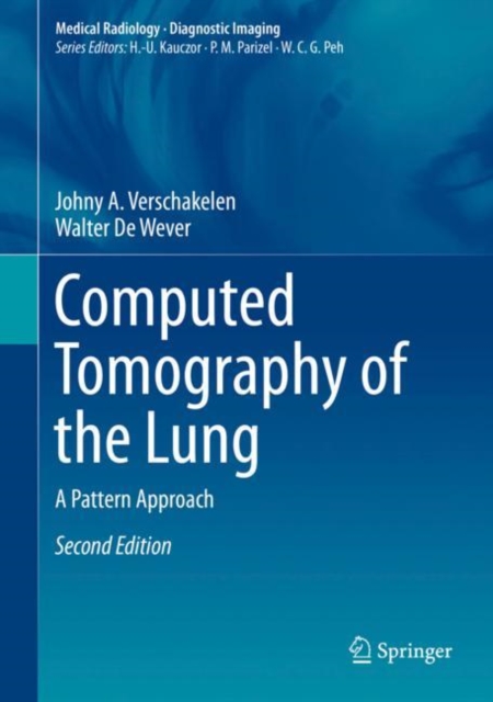 Computed Tomography of the Lung : A Pattern Approach, PDF eBook
