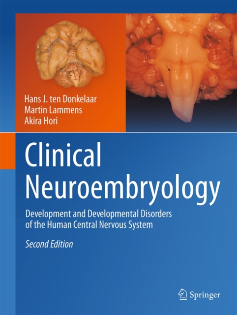 Clinical Neuroembryology : Development and Developmental Disorders of the Human Central Nervous System, Hardback Book