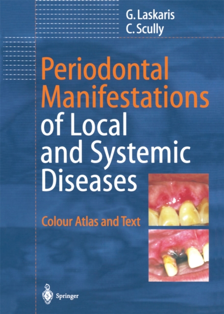 Periodontal Manifestations of Local and Systemic Diseases : Colour Atlas and Text, PDF eBook