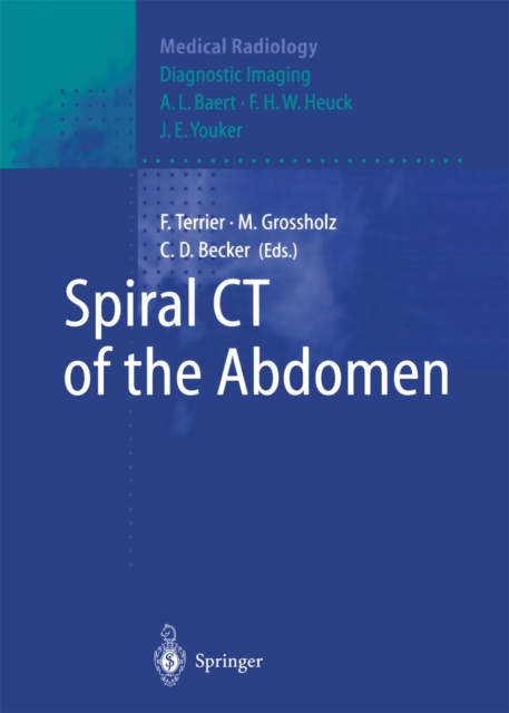 Spiral CT of the Abdomen, PDF eBook
