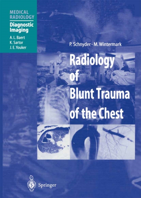 Radiology of Blunt Trauma of the Chest, PDF eBook