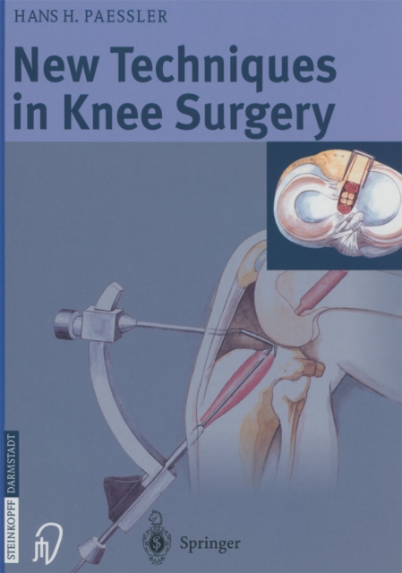 New Techniques in Knee Surgery, PDF eBook