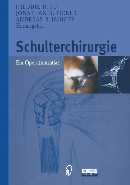 Schulterchirurgie : Ein Operationsatlas, PDF eBook