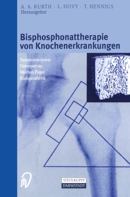 Bisphosphonattherapie von Knochenerkrankungen : Tumorosteolysen Osteoporose M. Paget Endoprothetik, PDF eBook