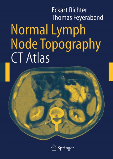 Normal Lymph Node Topography : CT Atlas, PDF eBook