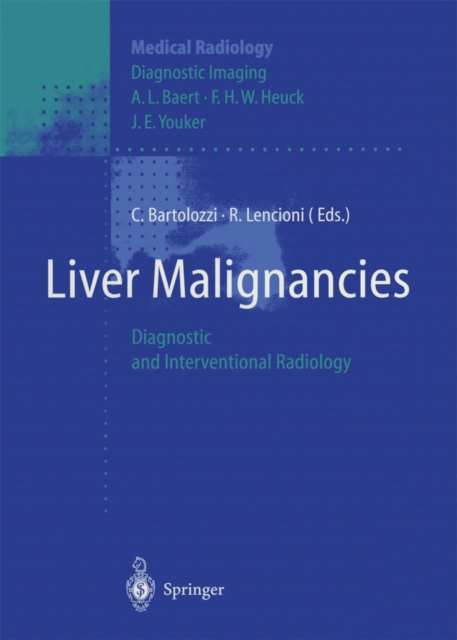 Liver Malignancies : Diagnostic and Interventional Radiology, PDF eBook