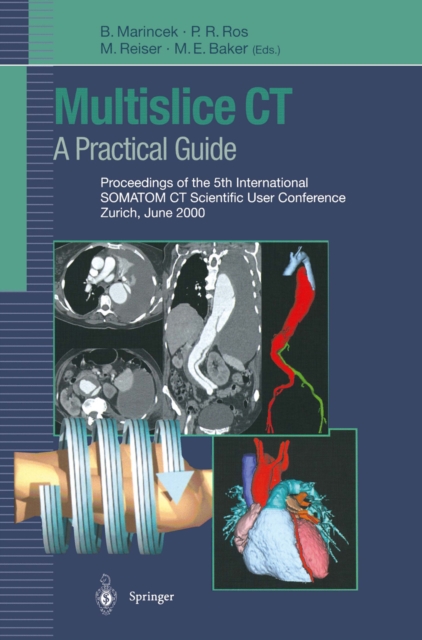 Multislice CT: A Practical Guide : Proceedings of the 5th International SOMATOM CT Scientific User Conference Zurich, June 2000, PDF eBook