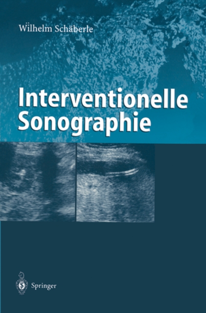 Interventionelle Sonographie, PDF eBook