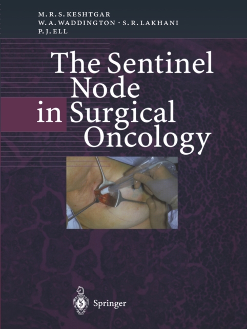 The Sentinel Node in Surgical Oncology, PDF eBook