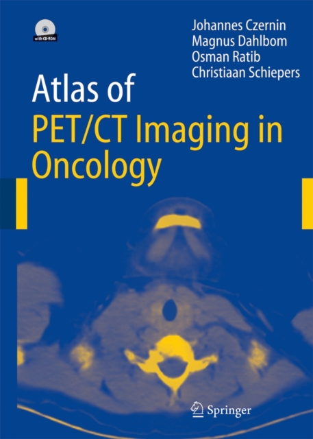 Atlas of PET/CT Imaging in Oncology, Paperback / softback Book