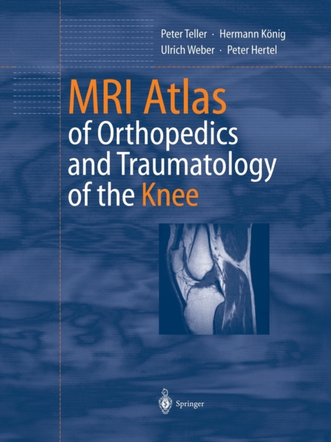 MRI Atlas of Orthopedics and Traumatology of the Knee, Paperback / softback Book