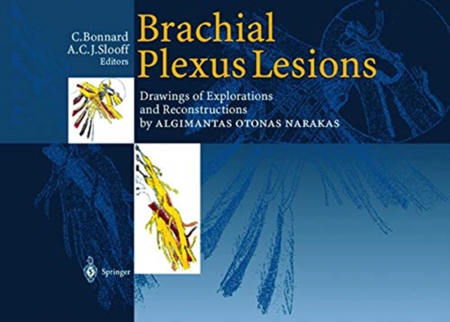 Brachial Plexus Lesions : Drawings of Explorations and Reconstructions by Algimantas Otonas Narakas, Paperback / softback Book