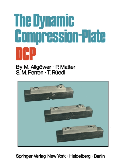 The Dynamic Compression Plate DCP, PDF eBook