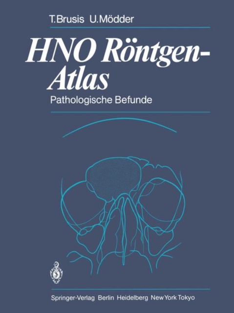 HNO Rontgen-Atlas, Paperback Book