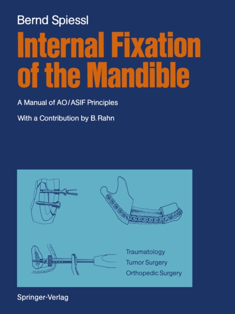 Internal Fixation of the Mandible : A Manual of AO/ASIF Principles, PDF eBook