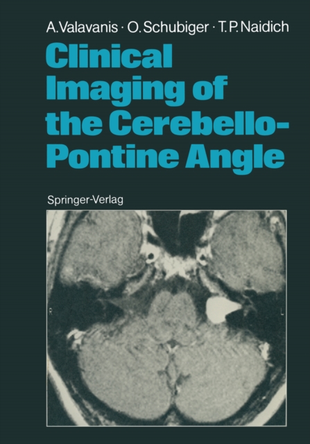 Clinical Imaging of the Cerebello-Pontine Angle, PDF eBook