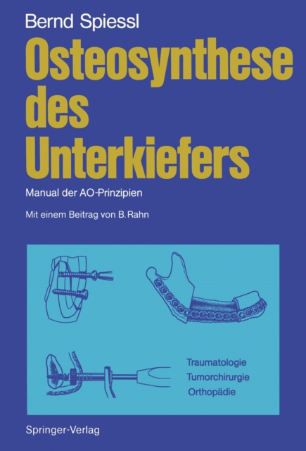 Osteosynthese des Unterkiefers : Manual der AO-Prinzipien, PDF eBook