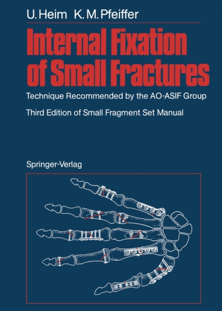 Internal Fixation of Small Fractures : Technique Recommended by the AO-ASIF Group, Paperback / softback Book