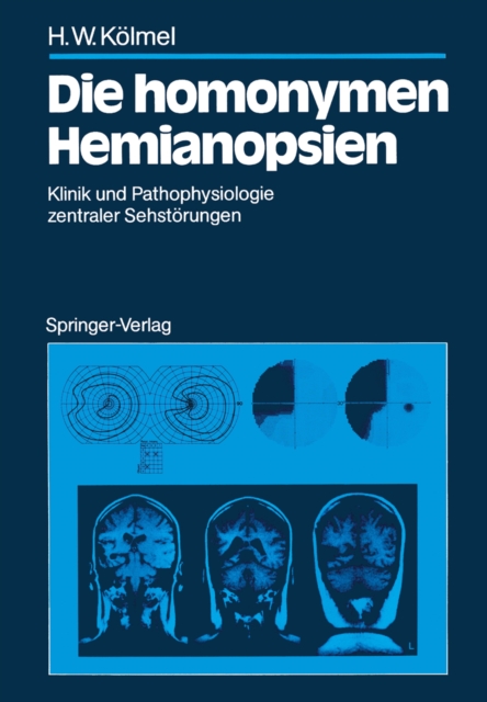 Die homonymen Hemianopsien : Klinik und Pathophysiologie zentraler Sehstorungen, PDF eBook