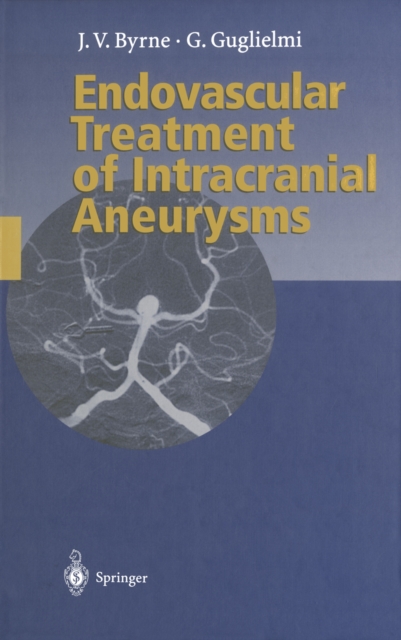 Endovascular Treatment of Intracranial Aneurysms, PDF eBook