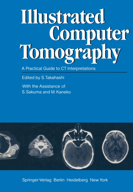 Illustrated Computer Tomography : A Practical Guide to CT Interpretations, PDF eBook