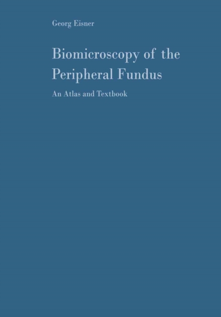 Biomicroscopy of the Peripheral Fundus : An Atlas and Textbook, PDF eBook