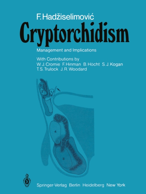 Cryptorchidism : Management and Implications, PDF eBook