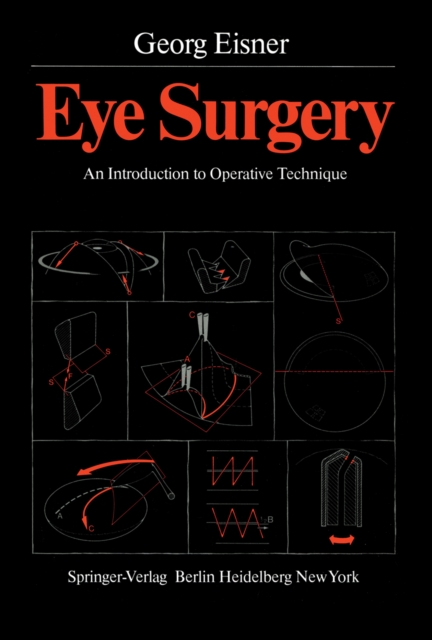 Eye Surgery : An Introduction to Operative Technique, PDF eBook