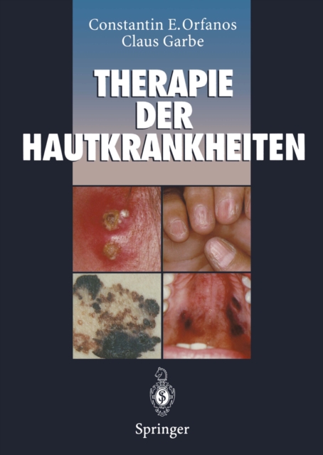Therapie der Hautkrankheiten : einschlielich Andrologie, Phlebologie, Proktologie, padiatrische Dermatologie, tropische Dermatosen und Venerologie, PDF eBook