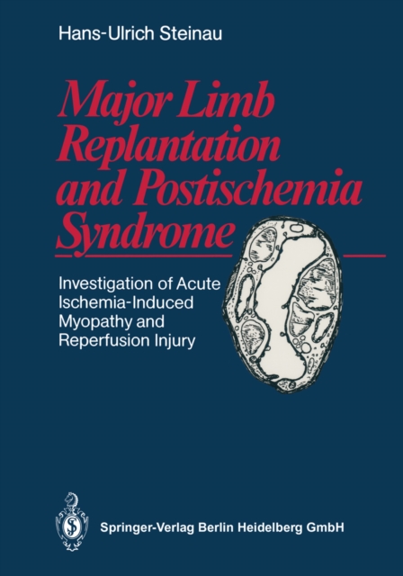 Major Limb Replantation and Postischemia Syndrome : Investigation of Acute Ischemia-Induced Myopathy and Reperfusion Injury, PDF eBook