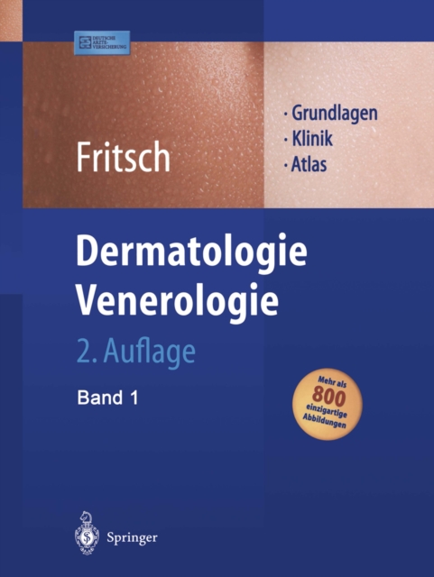 Dermatologie Venerologie : Grundlagen. Klinik. Atlas., PDF eBook