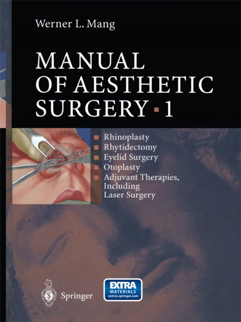 Manual of Aesthetic Surgery 1, PDF eBook