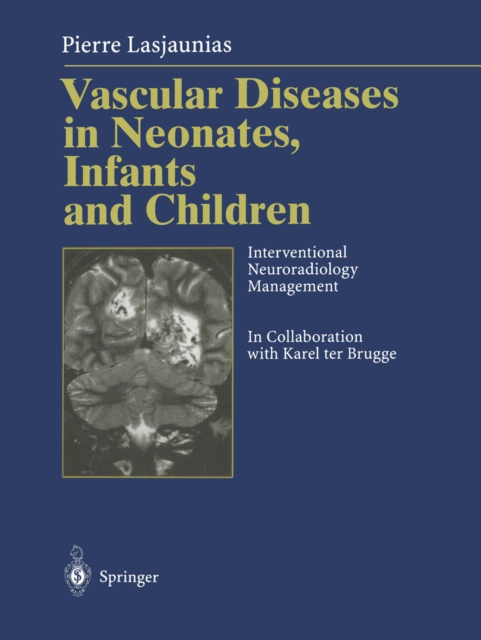 Vascular Diseases in Neonates, Infants and Children : Interventional Neuroradiology Management, PDF eBook