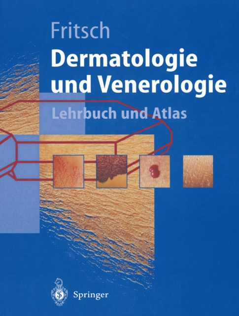 Dermatologie und Venerologie : Lehrbuch und Atlas, PDF eBook