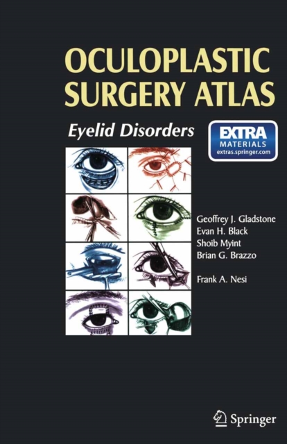Oculoplastic Surgery Atlas : Eyelid Disorders, PDF eBook