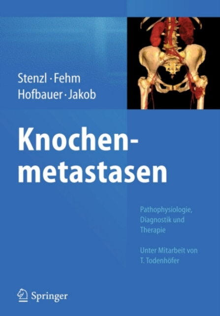 Knochenmetastasen : Pathophysiologie, Diagnostik und Therapie - Unter Mitarbeit von T. Todenhofer, PDF eBook