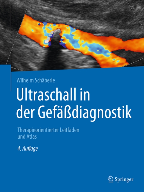 Ultraschall in der Gefadiagnostik : Therapieorientierter Leitfaden und Atlas, PDF eBook