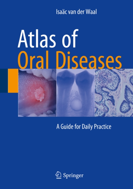 Atlas of Oral Diseases : A Guide for Daily Practice, PDF eBook
