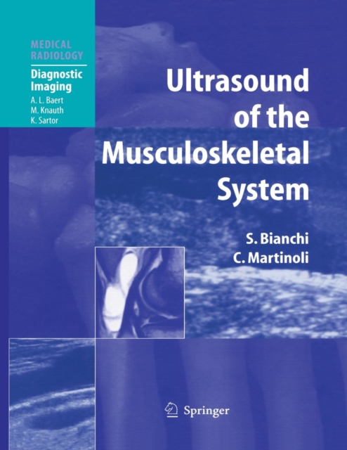 Ultrasound of the Musculoskeletal System, Paperback / softback Book