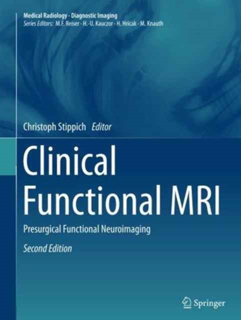 Clinical Functional MRI : Presurgical Functional Neuroimaging, Paperback / softback Book