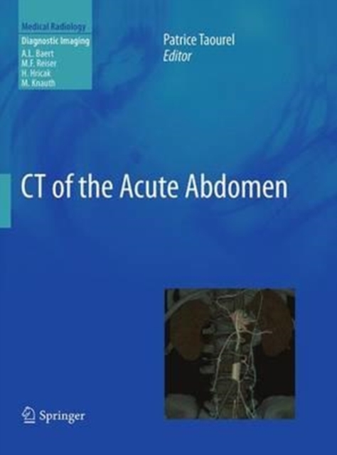 CT of the Acute Abdomen, Paperback / softback Book