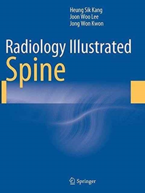Radiology Illustrated: Spine, Paperback / softback Book