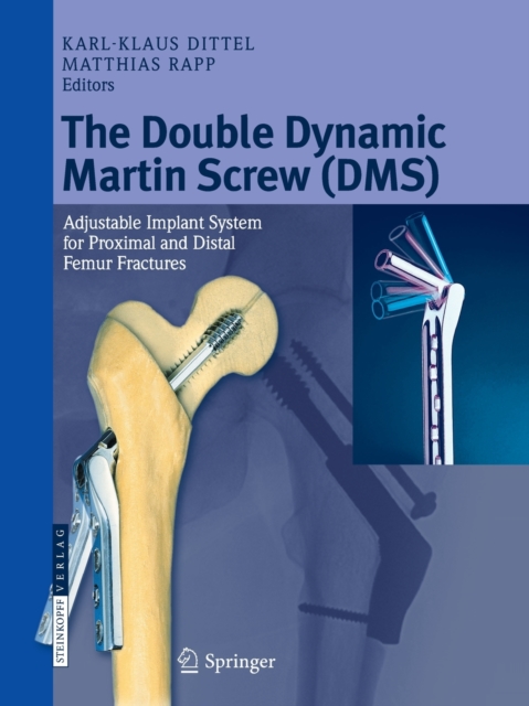 The Double Dynamic Martin Screw (DMS) : Adjustable Implant System for Proximal and Distal Femur Fractures, Paperback / softback Book